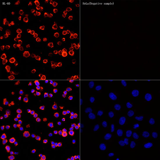 Myeloperoxidase (MPO) Rabbit mAb