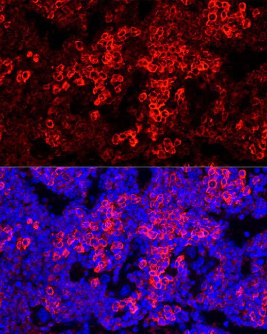 Myeloperoxidase (MPO) Rabbit mAb