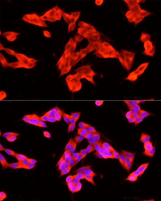 HTR3A Rabbit mAb