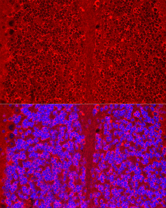 HTR3A Rabbit mAb