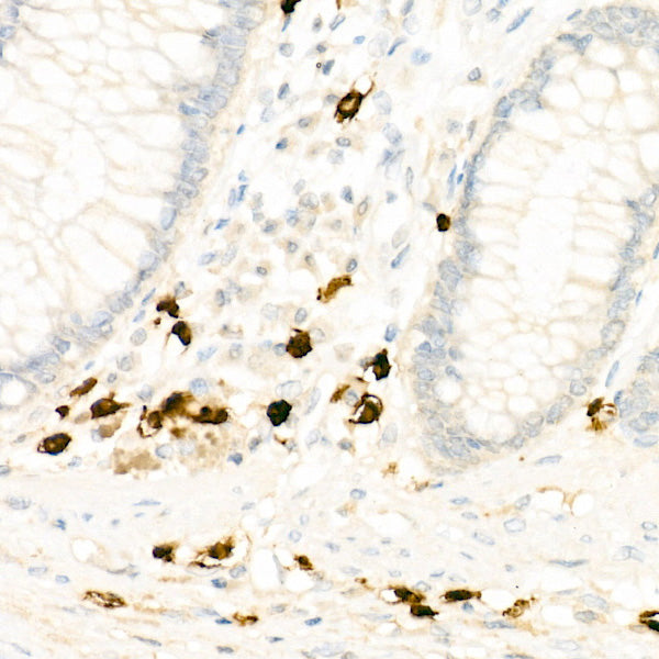 ALOX15 Rabbit mAb