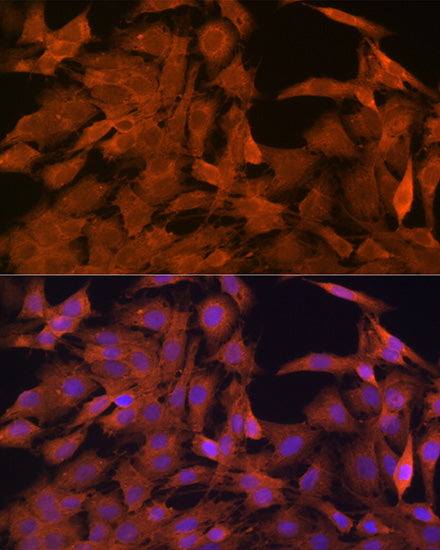 SRP54 Rabbit mAb