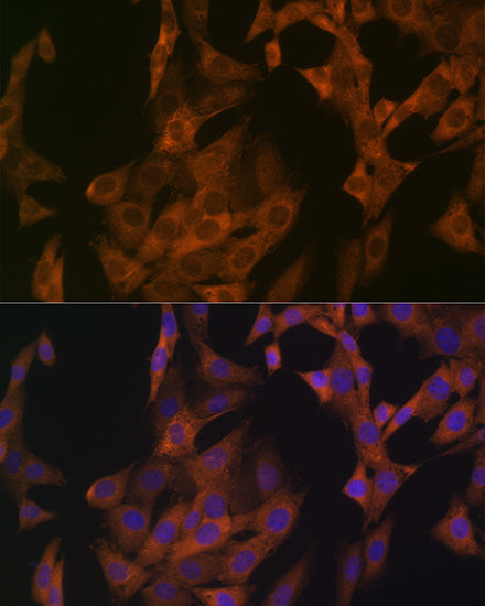 Zyxin Rabbit mAb
