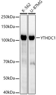 [KD Validated] YTHDC1 Rabbit mAb