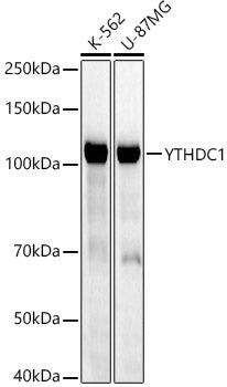 [KD Validated] YTHDC1 Rabbit mAb