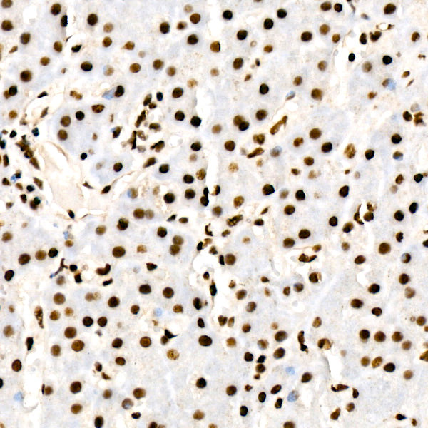 [KD Validated] YTHDC1 Rabbit mAb