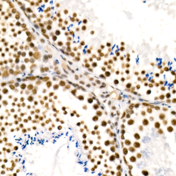[KD Validated] YTHDC1 Rabbit mAb