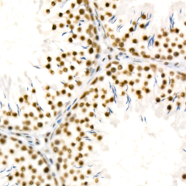 [KD Validated] YTHDC1 Rabbit mAb