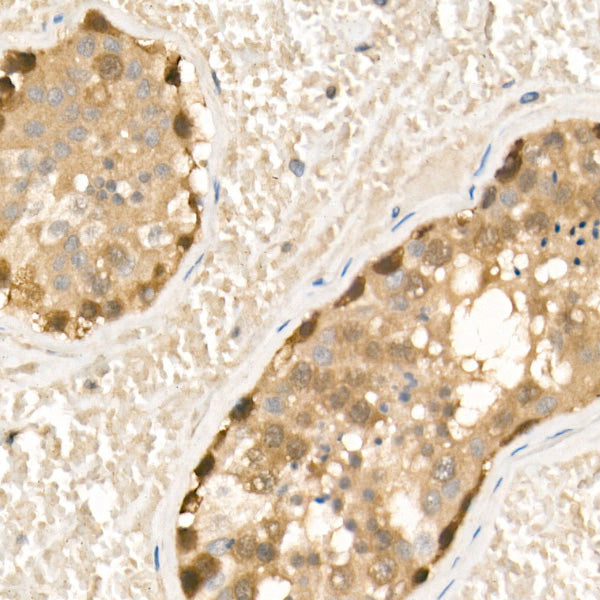 CBL Rabbit mAb