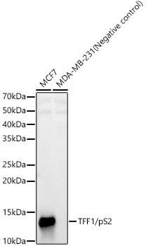 TFF1/pS2 Rabbit mAb