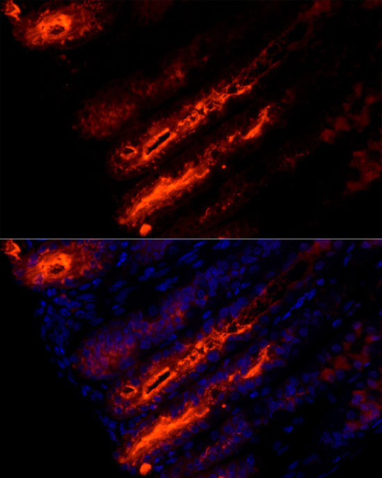 TFF1/pS2 Rabbit mAb