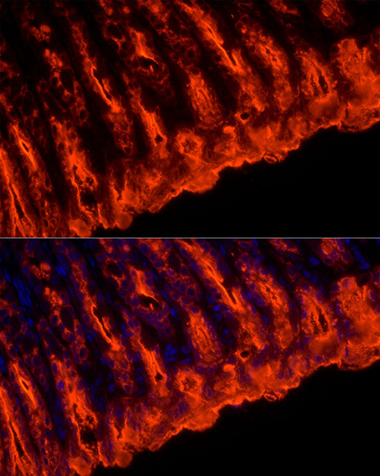 TFF1/pS2 Rabbit mAb