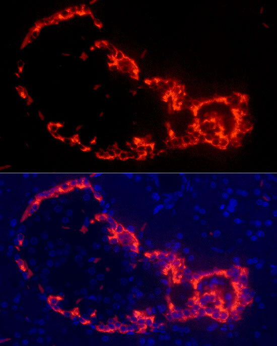 Glucagon Rabbit mAb