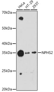 NPHS2 Rabbit mAb