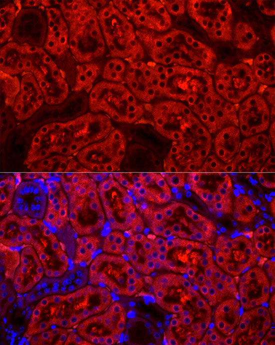 Cytochrome P450 2E1 (CYP2E1) Rabbit mAb