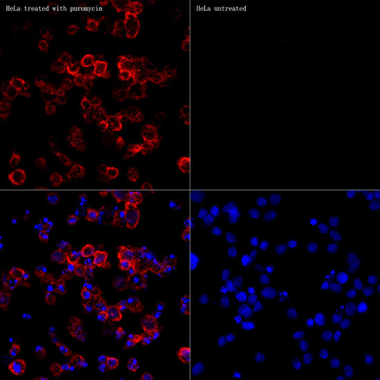 Puromycin Rabbit mAb