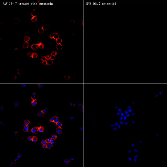 Puromycin Rabbit mAb