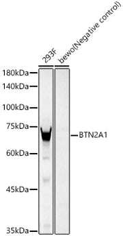 BTN2A1 Rabbit mAb