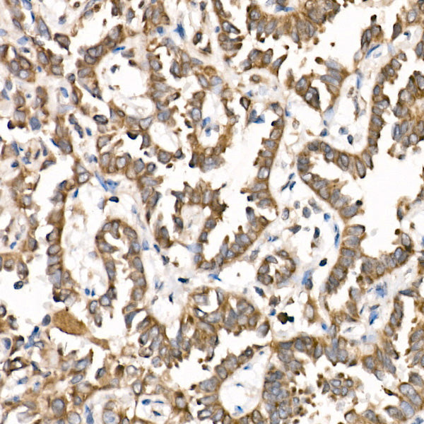 PTP1B Rabbit mAb
