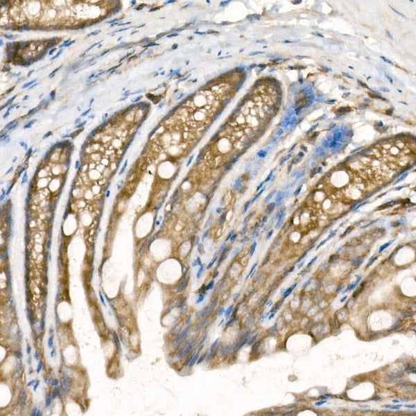 PTP1B Rabbit mAb