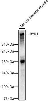 RYR1 Rabbit pAb