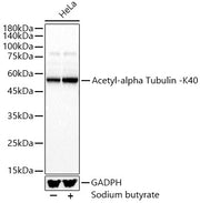 Acetyl-alpha Tubulin -K40 Rabbit pAb