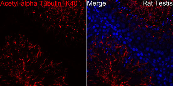 Acetyl-alpha Tubulin -K40 Rabbit pAb
