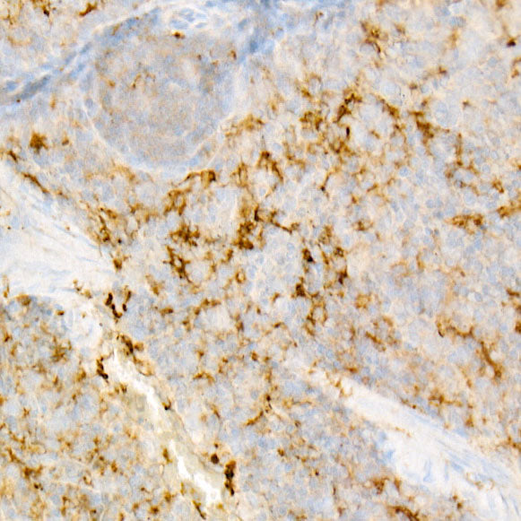 IL18 Rabbit mAb