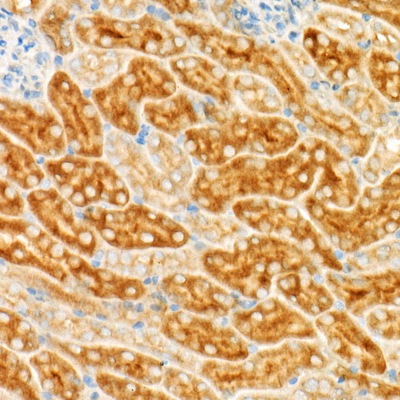 GCN2 Rabbit mAb