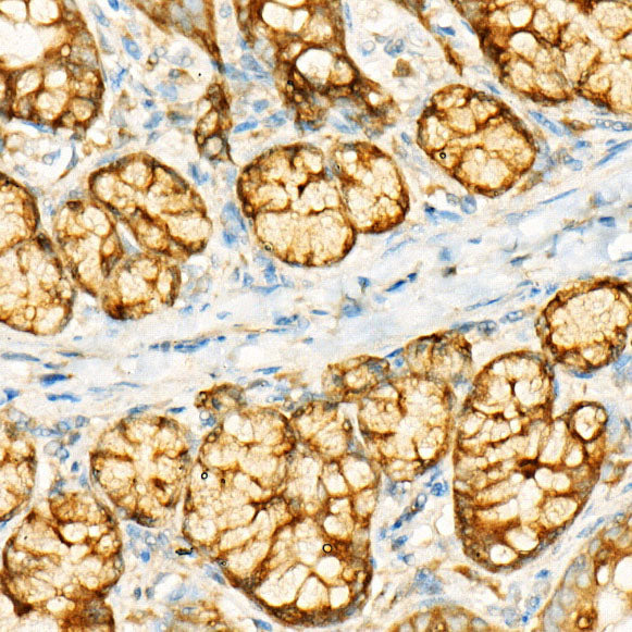 GCN2 Rabbit mAb