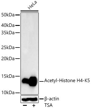 Acetyl-Histone H4-K5 Rabbit mAb