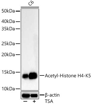 Acetyl-Histone H4-K5 Rabbit mAb