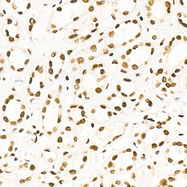 Acetyl-Histone H4-K5 Rabbit mAb