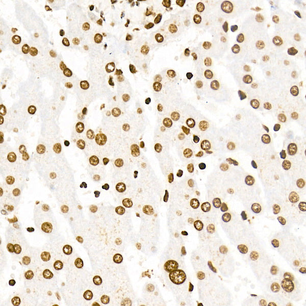 Acetyl-Histone H4-K5 Rabbit mAb