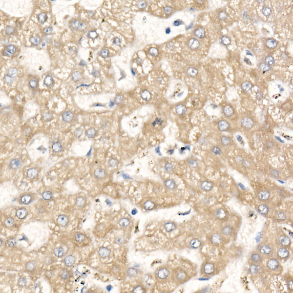 MGLL Rabbit mAb