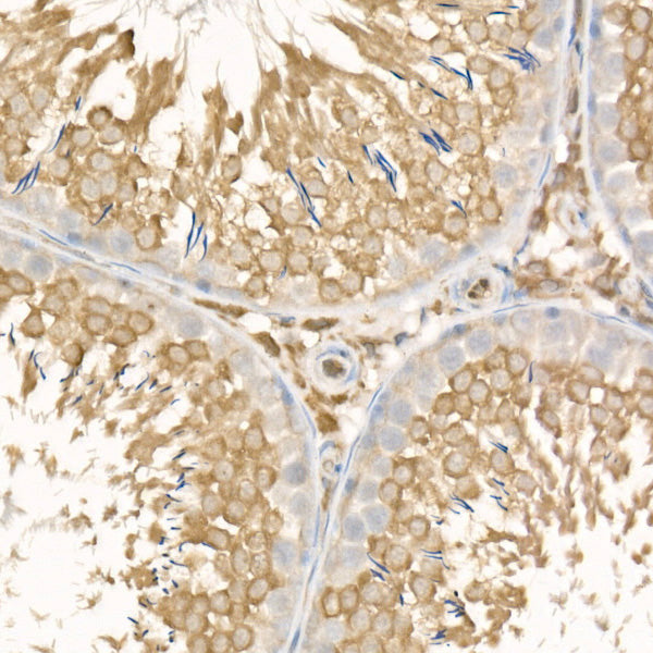 MGLL Rabbit mAb