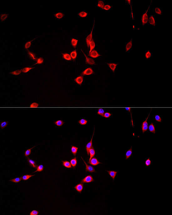 MGLL Rabbit mAb