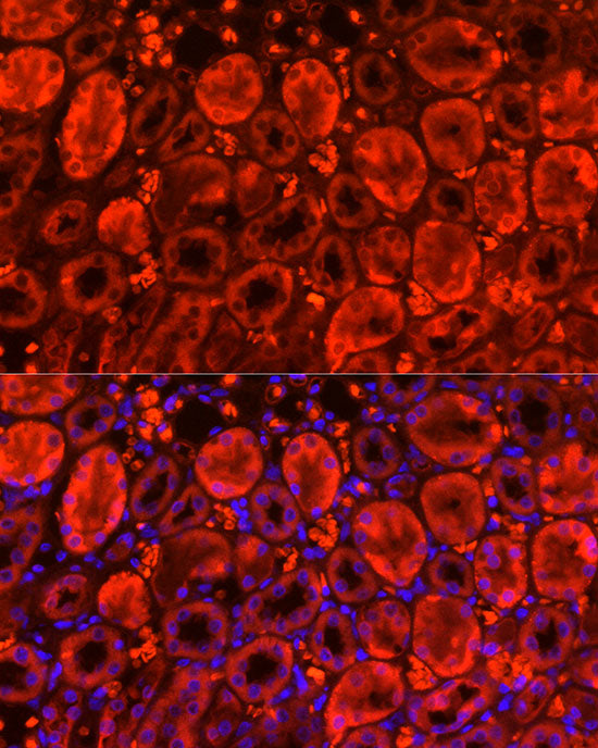 MGLL Rabbit mAb