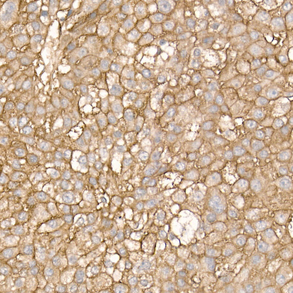 CD155/PVR Rabbit mAb