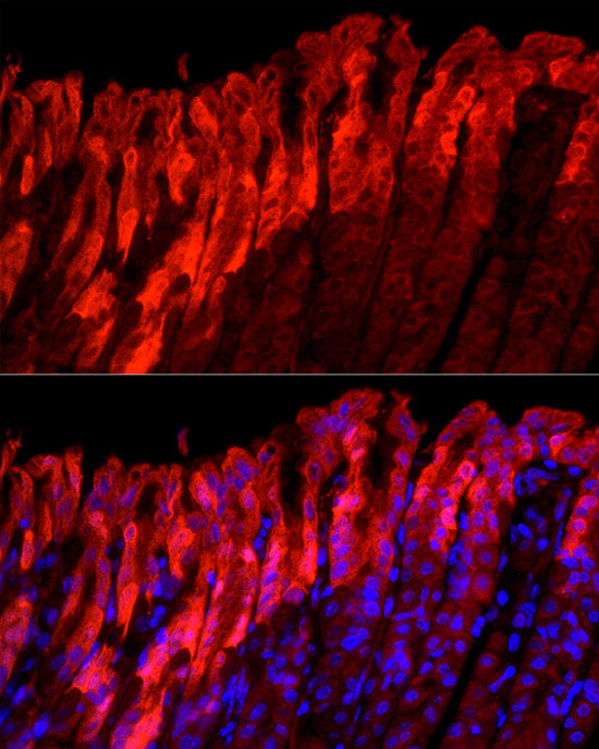 ALDH3A1 Rabbit mAb