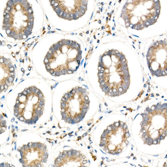 HEXA Rabbit mAb