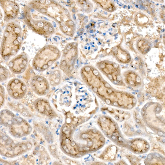 HEXA Rabbit mAb