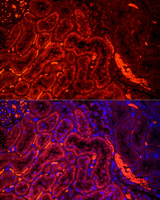 HEXA Rabbit mAb