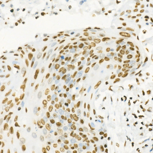 Acetyl-Histone H4-K16 Rabbit mAb