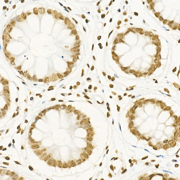 Acetyl-Histone H4-K16 Rabbit mAb