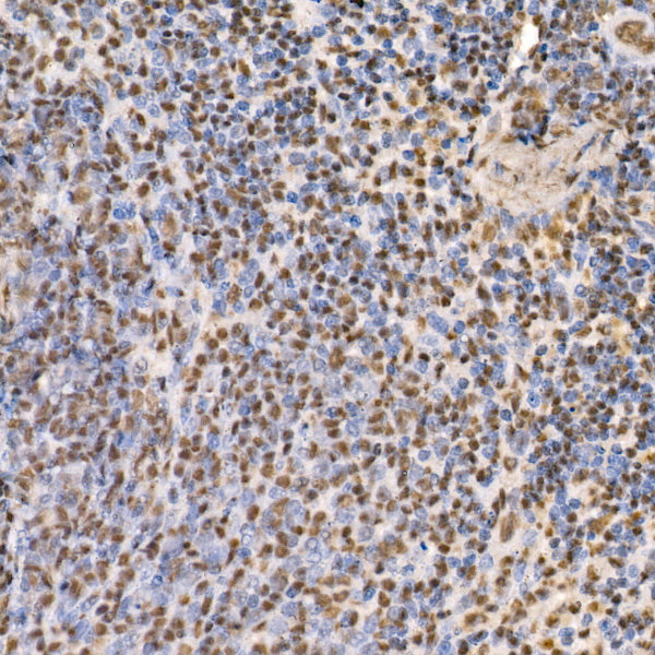 GLI2 Rabbit mAb