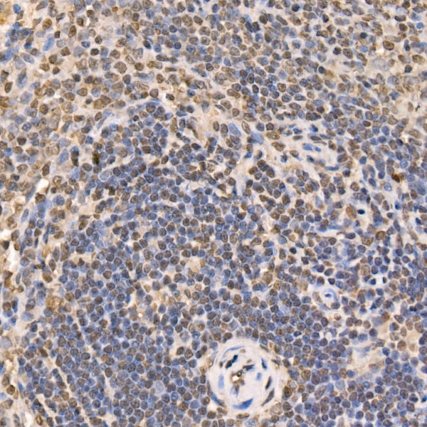 GLI2 Rabbit mAb