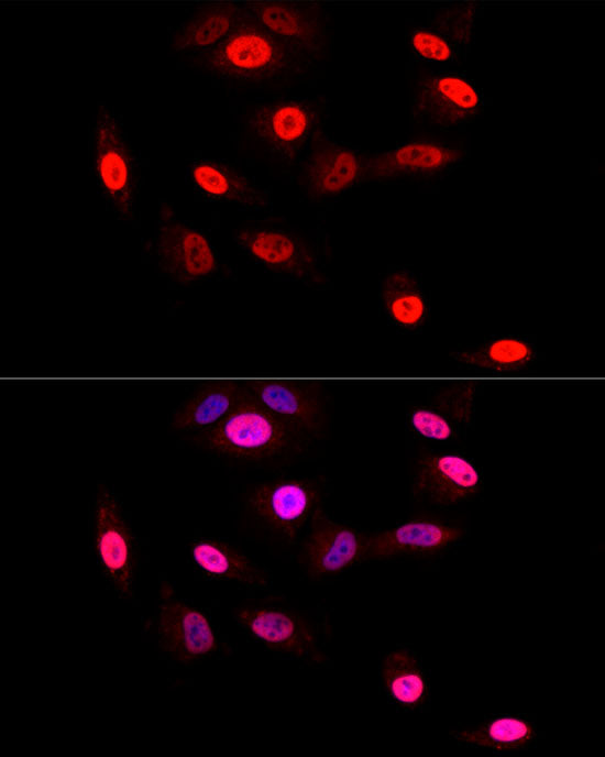 GLI2 Rabbit mAb