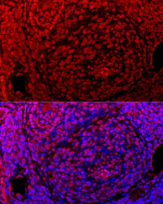 GLI2 Rabbit mAb