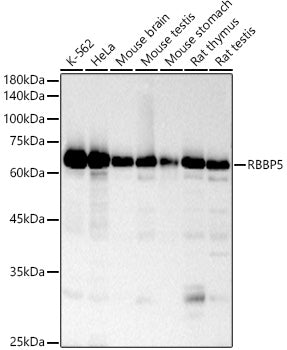 RBBP5 Rabbit mAb